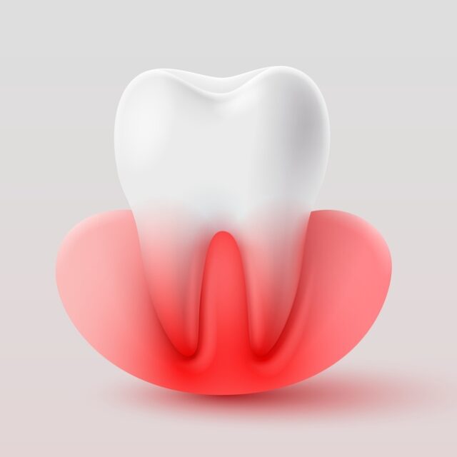 أفضل طرق لعلاج جذور الأسنان في الأردن: أين يمكنك العثور على أفضل علاج؟